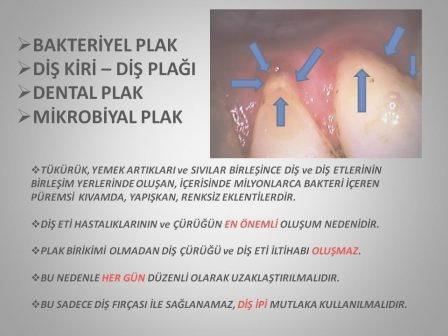 periodontoloji