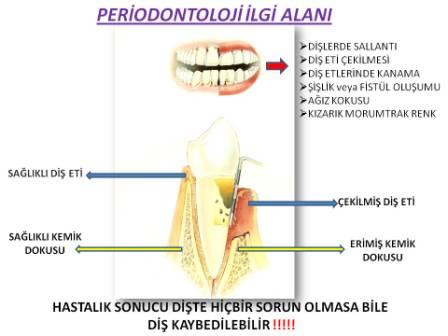 periodontoloji